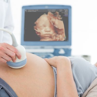 échographie 3D de votre bébé